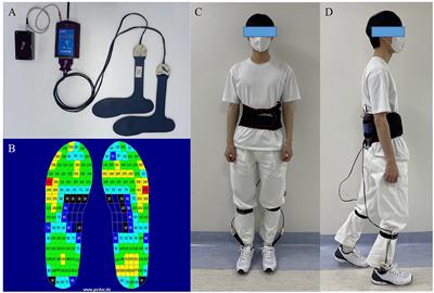 Detection of freezing of gait in Parkinson's disease from foot-pressure sensing insoles using a temporal convolutional neural network